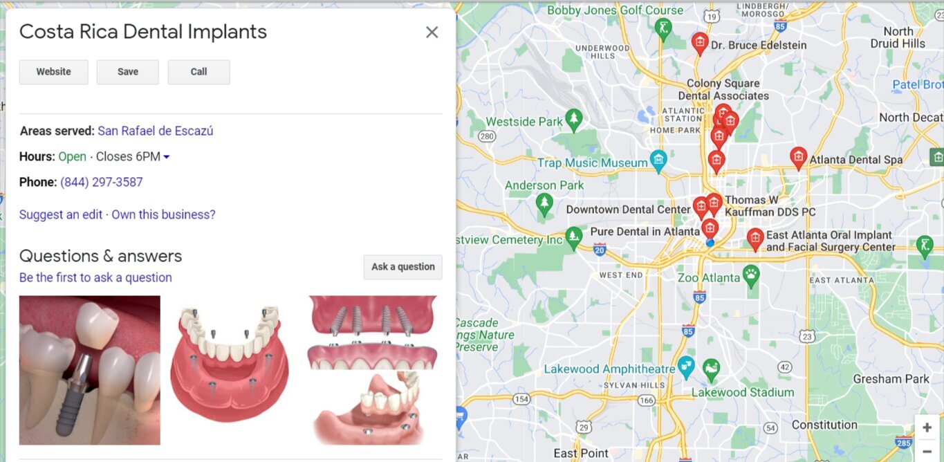 dental-implants-Google-Search (1).jpg